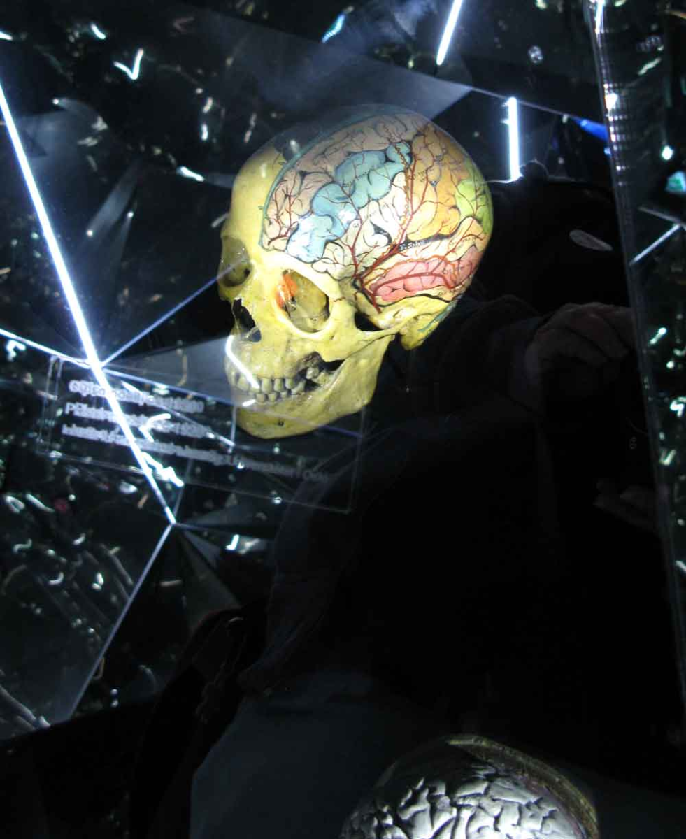 brain 