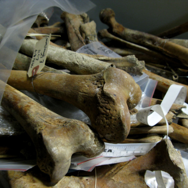 bones