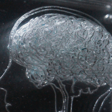 brain in acrylic slices