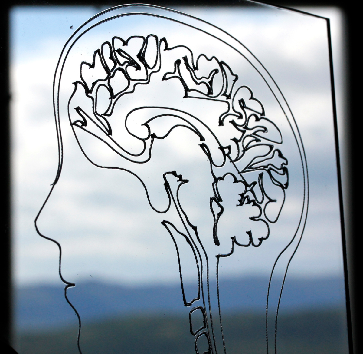 pretty cerebellum