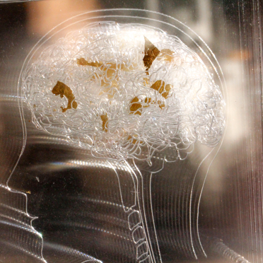 my brain