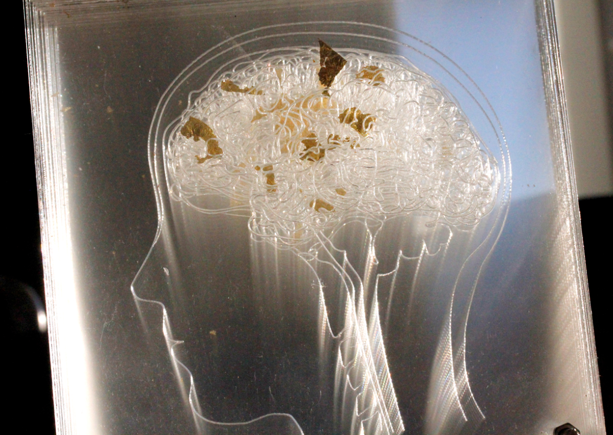 my brain