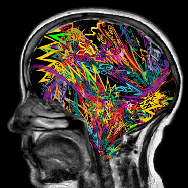explosive brain